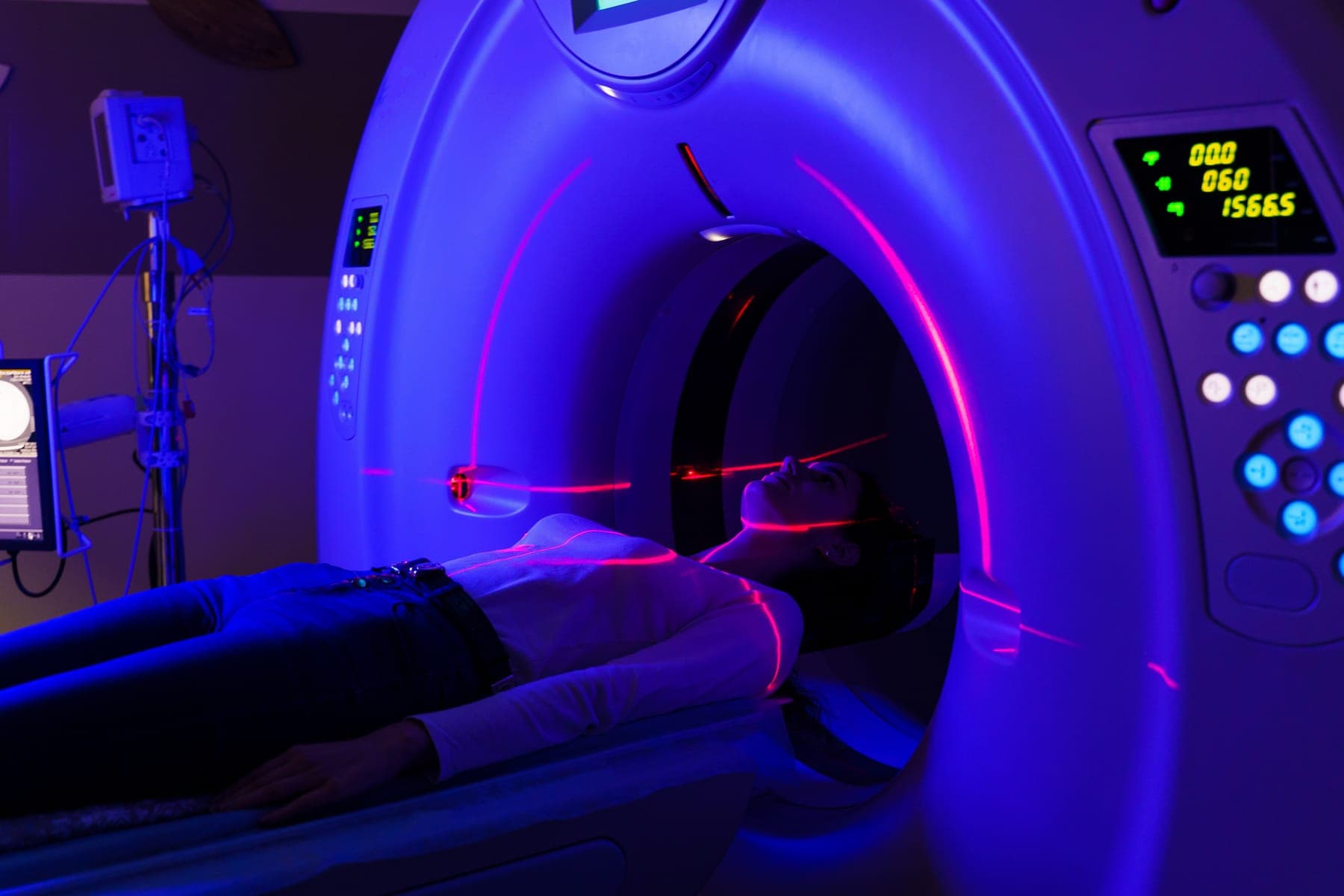 Laser line scanner performing machine vision inspection — illuminated by Advanced Illumination LED lighting